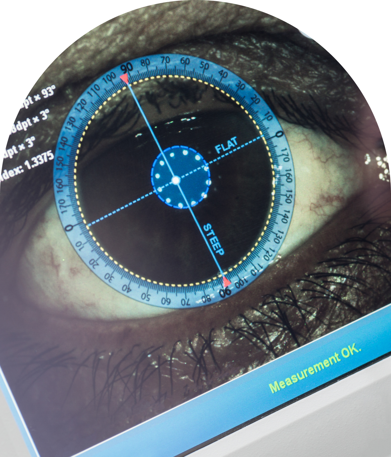 Vision Services from LASIK to Cataract | Modern Eye